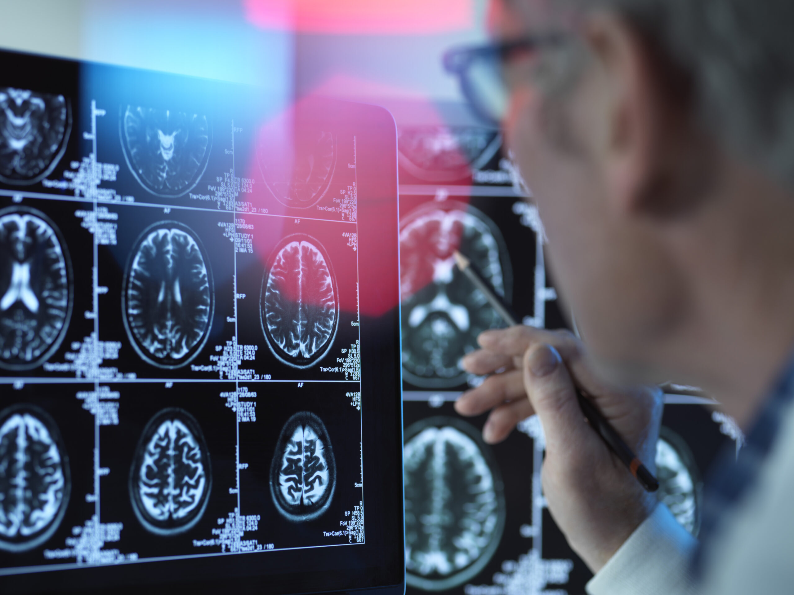 Consulta de Neurología en Hospital Americano Quito